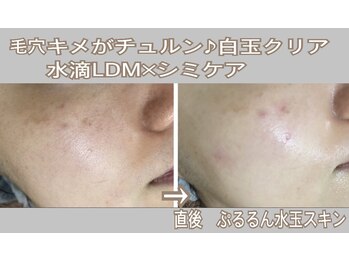 アルページュ(Arpege)/モッチリ潤い色白×シミケア