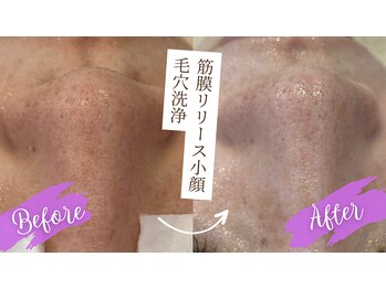 ルー(Lu)/毛穴の目立ちに◎！