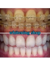 ホワイトニングショップ 本八幡店/Before&After美白ホワイトニング