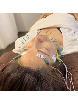 蒼月(aotsuki)/美容鍼