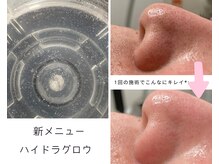 チッチ(CHiCCHi)の雰囲気（【毛穴ツルピカ!モテ肌へ 】顔の古い角質、汚れがごっそり取れる）