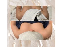 サローネデルセーノ(salone del seno)/