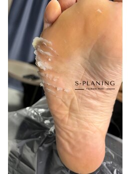 サロン ド ネイル 椿(Salon de nail 椿)/韓国式角質ケア