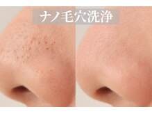 VS28スキンケアスタジオ バリイン 札幌駅前(BALI IN)の雰囲気（人気第1位☆ナノ毛穴洗浄!汚れを徹底オフ!肌の仕上がりに感動♪）