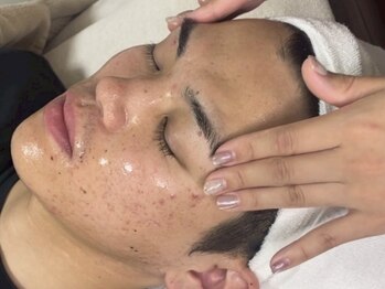 ビズビズ 梅田店(bisebise)の写真/new＼施術実績80万名以上★ニキビケア専門店／ニキビケア・赤み・肌質改善￥3800★全スタッフ資格保持