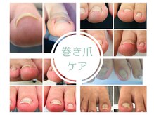 ココネ(cocone)の雰囲気（効果抜群☆痛みの少ない巻き爪解放ケア！数回で改善続出中！）