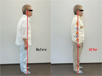 シームル/猫背矯正/姿勢改善（60代男性）