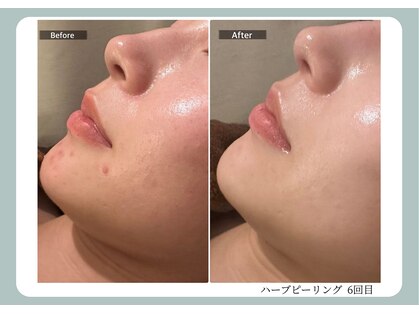 エミルカ 宮崎店(EMILUCA)の写真