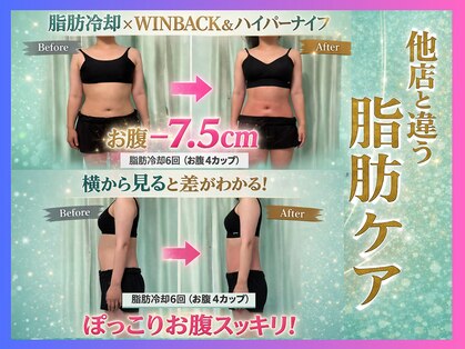 ボディーリセット 勝どきの写真
