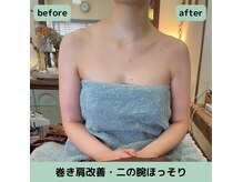 オンリ(ONRI)の雰囲気（人気NO1【繰り返すニキビケアに◎】）