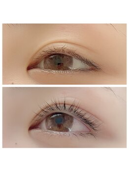 ラフィーネ(Raffine)/アッパーリフトカール