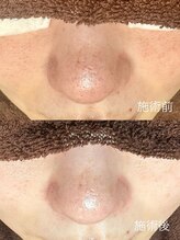 エクラ バイ シャンリィ(eclat by shanLy)/ブラビティシリーズ大人気！