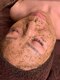 ベーシックビューティー(Basic Beauty)の写真/<毛穴の黒ずみ/ざらつき/乾燥>などにお悩みの方必見☆話題のREVI【陶肌トリートメント】でつるすべ美肌に♪