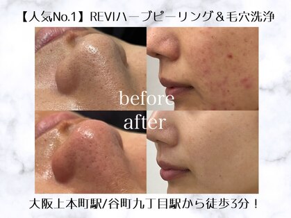 ルテア(Retea.)の写真