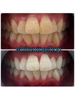 ホワイトニングショップ 倉敷店/