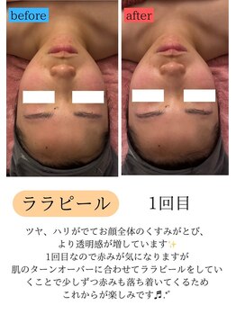 ユフラ(Juhla)/ララピール