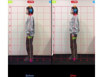 ケアハウス 戸塚(CARE HOUSE)/施術効果写真☆（before after）