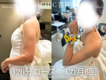 ラシク 吉祥寺(LACHIC)/二の腕／ブライダル