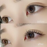 アネラプラス(ANELA Plus+)