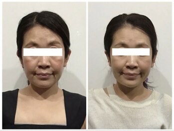 シンメトリー 麻布十番/Before/After