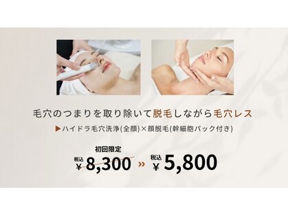 バニスター(Bannister)の写真