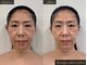「小顔に本気。」都度払い小顔専門店beauty salon seloveの写真/別府NEW OPEN★ほうれい線・たるみを土台から改善&予防!初回￥7800/コース契約一切なし完全都度払い♪