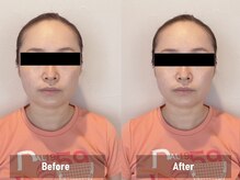 ミニョン(mignon)/