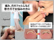 アンジュネイル(Angenail)の雰囲気（夏に向けて巻き爪改善！巻き爪矯正専門スタッフが全面サポート！）