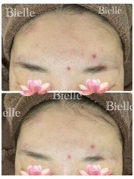 ビエル(Bielle)/花粉黄砂が舞う季節的なゆらぎ肌