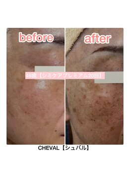 シュバル(CHEVAL)/徹底シミ改善！