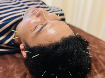 茶ノ木鍼灸整骨院/美容鍼 美肌トリートメント