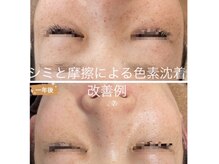 フラン(franc)の雰囲気（諦めかけていたシミや肌荒れなどご相談ください♪）