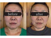 りせる整体院(Recell)/小顔矯正３回目　変化