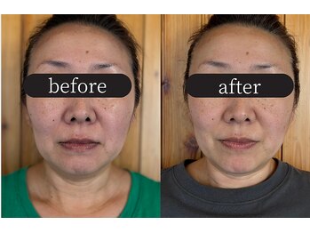 りせる整体院(Recell)/小顔矯正3回目 変化