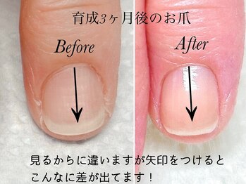 トゥインクリーネイルサロン(Twinkly Nail Salon)/【地爪育成】1回お試し