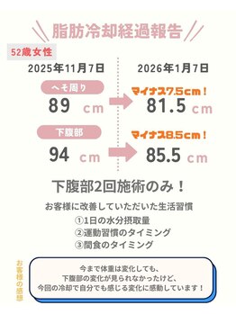 ココ(Coco)/脂肪冷却／痩身