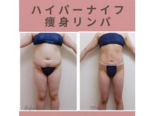 グレースフル 天文館店の雰囲気（ハイパーナイフ&骨盤矯正、痩身リンパで脂肪撃退）