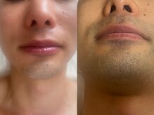 エステティック 華/