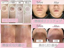 アモ 夢シティ新下関(AMO.)