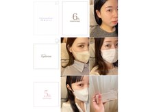 ミニョン(mygnon.)の雰囲気(\Instagram随時更新中/)