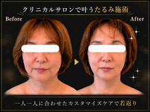 リオ(Rio)の雰囲気（オーダメイドケアでキュッと引き締め◎【滋賀/草津】）