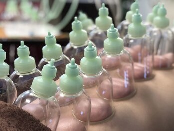 佳園/吸玉カッピング