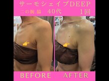 リラクゼーションサロン ラキ(laki)/サーモシェイプDEEP1回40代/痩身