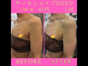 リラクゼーションサロン ラキ(laki)/サーモシェイプDEEP1回40代/痩身