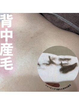 エンジェルワックス 新宿店(Angel Wax)/背中脱毛