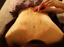 ソレイユ麻布鍼灸整体院/全身の疲れに