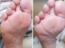 リゼラアンドコー 天童・PONO/ドイツ式フットケア専門店