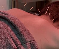 ヒトハリ鍼灸整体院(HITOHARI鍼灸整体院)