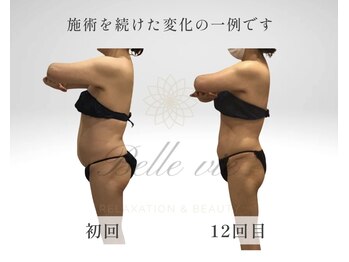 ベルヴィー/40代以上のダイエットが得意