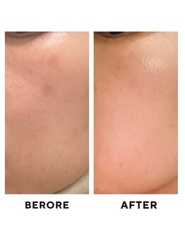 ゼロ 水戸店(ZERO)/ダクトピール